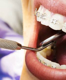 Ортодонтия